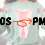 PCOS